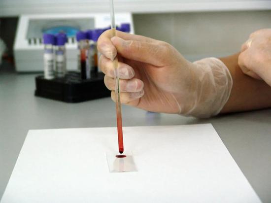 医药生物行业：阿尔茨海默血液检测进入集中突破期医药生物行业：阿尔茨海默血液检测进入集中突破期